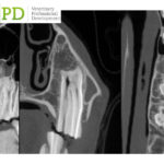 VetPD Panel Discussion - Dental Imaging Case-Discussion - X-ray vs. CT Decision Making, Acquisition & Techniques