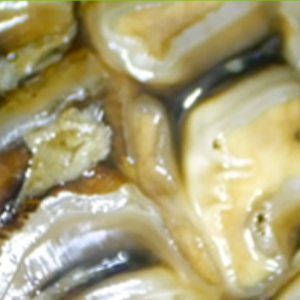 VetPD Panel Discussion - Management of Fractured Teeth